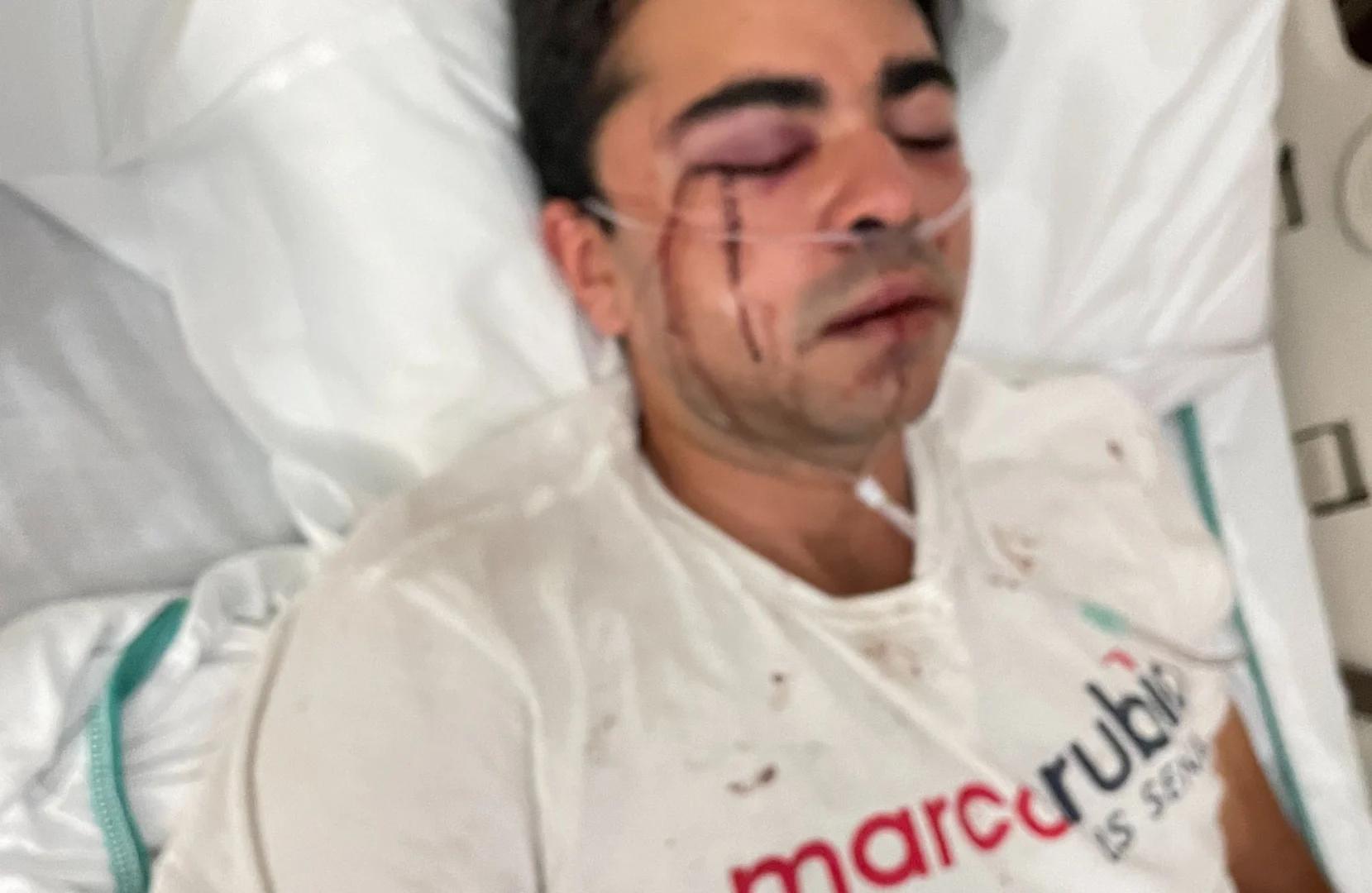 Republican campaign canvasser seriously injured in brutal attack