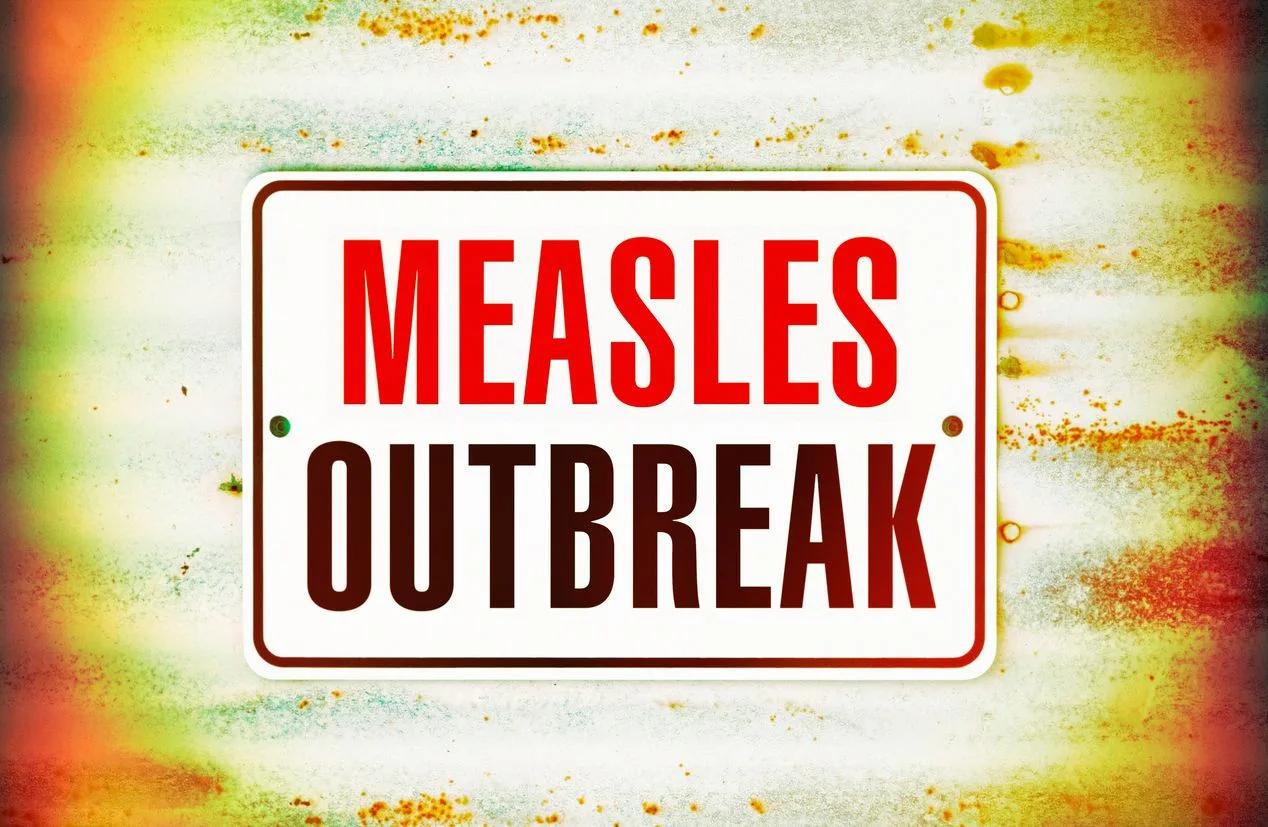 Measles by the numbers - perspective to the panic